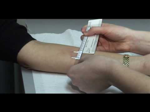 how to properly administer tb skin test