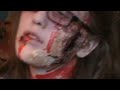 Thumbnail #1