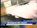 Breast Cancer Screening in Women with Implants Detroit Michigan.mp4
