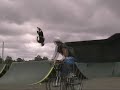 Failed backflip on a Scooter.. haa Failed backflip on a Scooter.. haa