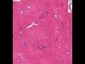 Shotgun Histology Dense Bone