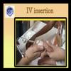 Pediatric IV insertion