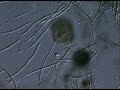NostocPseudomicrothorax