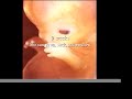 Fetal development PSA Fetal development PSA