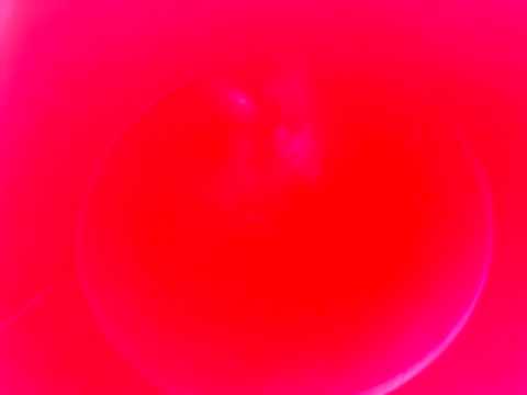 Girl falls down slide and breaks neck