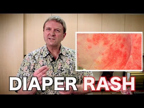 how to treat a yeast diaper rash