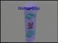 Treatment of Varicose and Spider Veins - Part 1