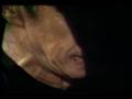 Kicked By a Horse, Shaman Woman Blind In Left Eye