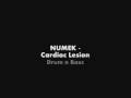 videos de Numek - Cardian Lesion