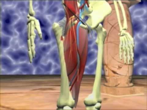 hernioplastia - Descripción anatómica de la región inguinal, tanto interna como externa en un modelo tridimensional virtual en 3D diseñado por ordenador. Técnica quirúrgica ...