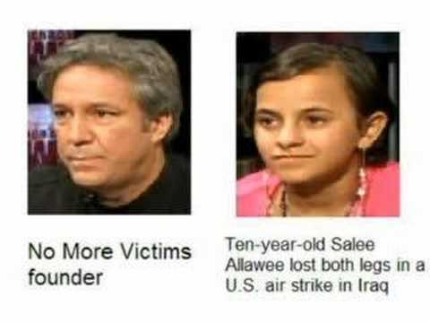 Ten-year old girl lost both legs in ...