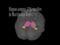 Brain Damage Data from Marijuana Use / Anti-Marijuana Educational Video PSA  Drug Abuse Marijuana Abuse