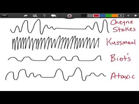how to treat kussmaul respirations