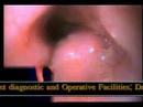 video-endoscopy-of-severe-gastritis.html