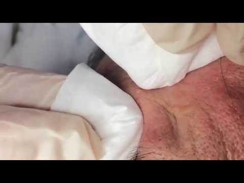 how to eliminate sebum