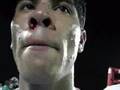 Theron DeLorme Post-Fight Interview