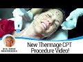 New Thermage CPT Procedure Video! - Dr. Bill Johnson