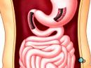PreOp® Patient Education:  GI Endoscopy Upper GI Surgery 1
