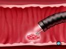 3d-medical-animation-upper-gi-endoscopy.html