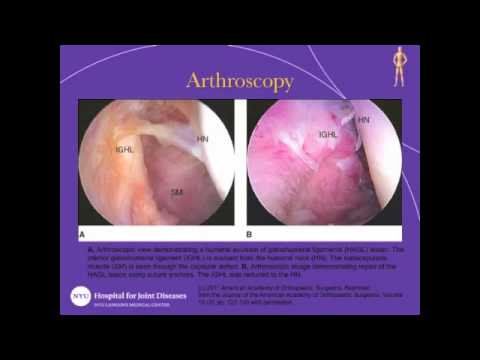 how to treat avulsion