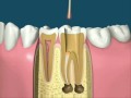Endodontia