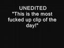 Jacoby of Papa Roach--UNEDITED Scarred