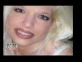 Donna Hogan gets Breast Implants Breast Implants