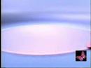 Breast Cancer - Breast Check Demonstration #2