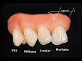 Ceramica odontologica diferenca entre natural x sintetica