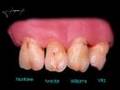 Ceramica odontologica diferenca entre natural x sintetica