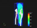 Optimization in Hyperthermia Cancer Treatment Planning