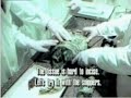 **SHOCKING ** LEAKED RUSSIAN 'KGB' ALIEN AUTOPSY!!!