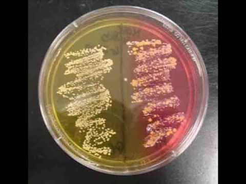 how to isolate bacteria from agar plate