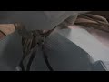 dialysis