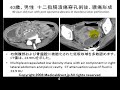 ??????CT?????CT attenuation value in the fluid of abscess?