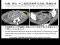 膿瘍の液体のCT値とは？　CT attenuation value in the fluid of abscess?