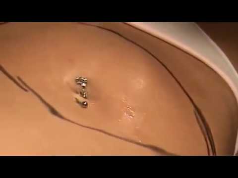 Video > Mesoterapia en abdomen