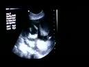 Sonogram / Echographie (2007.07.23)
