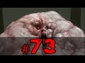 CUSTOM CAMPAIGNS - Left 4 Dead 2 With People/Subs Part 73 - I'm A HERO!