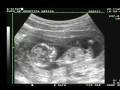 Nuestro o nuestra bebe. 12 semanas!!!