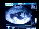 Nuestro bebe en la 11ava semana!!