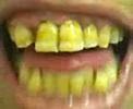 koops crazy dirtiest site green nasty horrible breath bad
