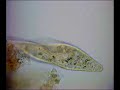 Vacuole Formation in Paramecium