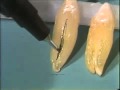Dental Anatomy: The Canine Teeth