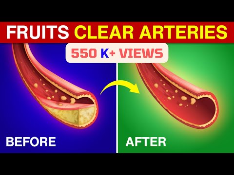 The BEST Fruits to CLEAN Your Blood Vessels