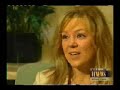 Houston Cosmetic Dermatology, Acne Laser Treatment