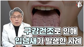 구강건조로 입냄새가 나는 경우