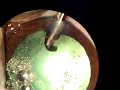 Facoemulsificação IA com ponteira de 45 graus Facoemulsificação IA com ponteira de 45 graus