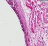 Histopathology-Lung-