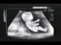 baby schumi baby schumi
